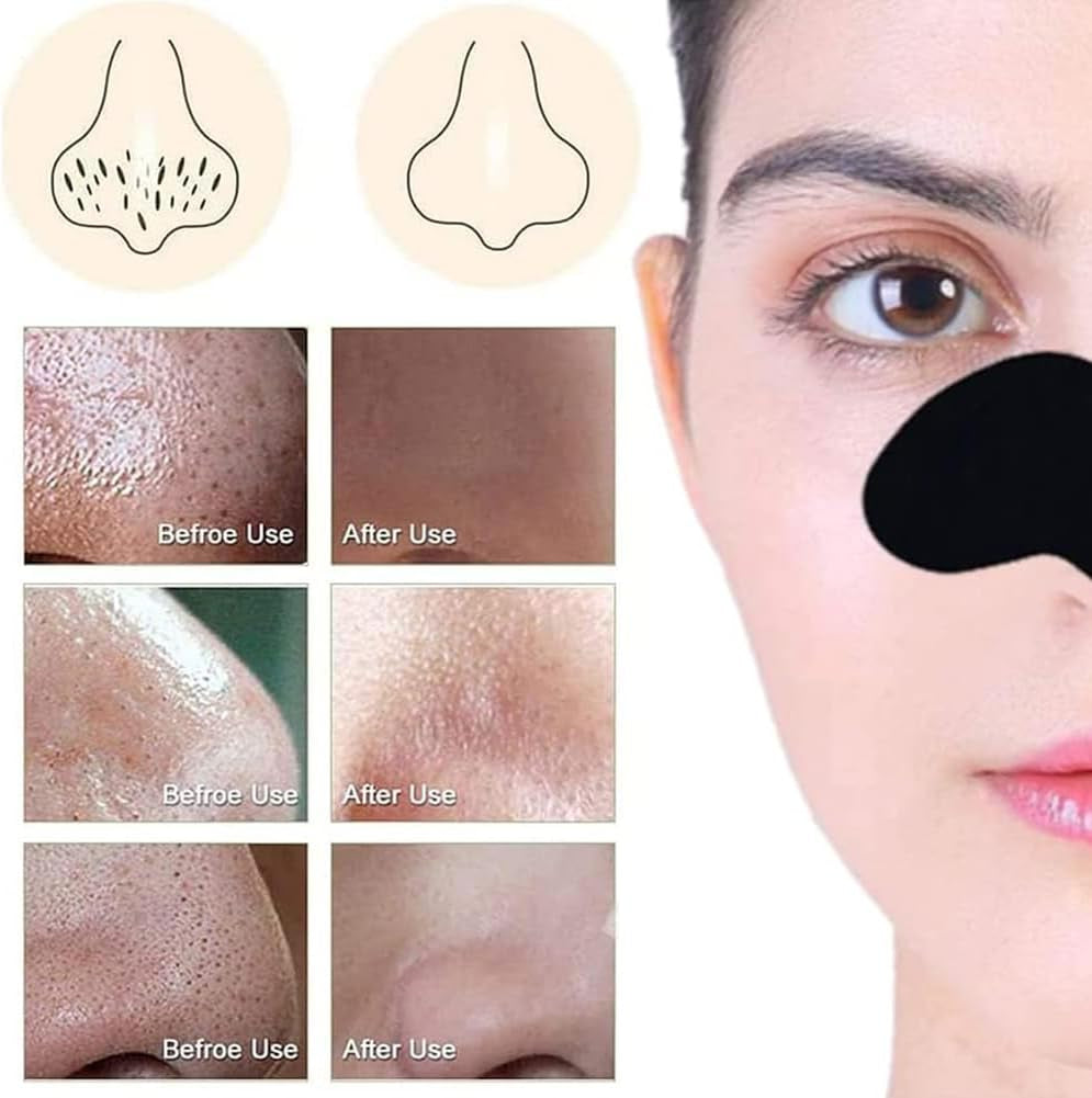 Tiras Nasales Eliminación Puntos Negros,38Pcs Tiras De Espinillas,Blackhead Nose Strips,Nose Strips,Blackhead Nose Strips, Tiras De Limpieza Profunda,Tiras De Carbón anti Puntos Negros